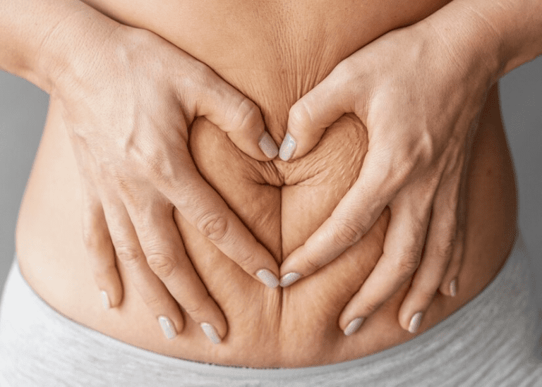 Face-to-Face and eLearning Stoma Training for Nurses and Carers